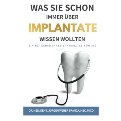 Abbildung von Was Sie schon immer über Implantate wissen wollten: Ein Ratgeber Ihres Zahnarztes für