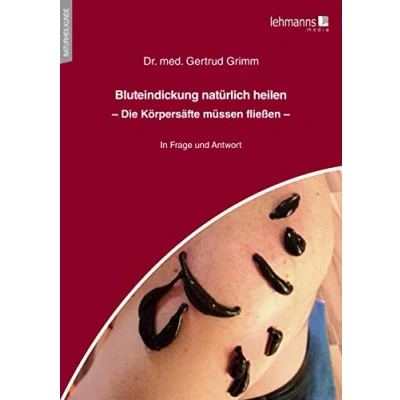 Abbildung von Bluteindickung natürlich heilen: Die Körpersäfte müssen fließen