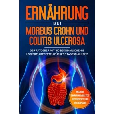 Abbildung von Ernährung bei Morbus Crohn und Colitis Ulcerosa: Der Ratgeber mit 100 bekömmlichen &amp; leckeren Rezepten für jede Tagesmahlzeit Inklusive Ernährungsansätze, Suppenrezepte Wochenplaner