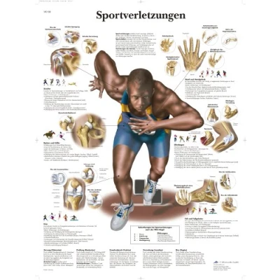 Abbildung von 3B Scientific Lehrtafel Sportverletzungen, VR0188UU