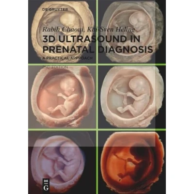 Abbildung von 3D Ultrasound in Prenatal Diagnosis: A Practical Approach