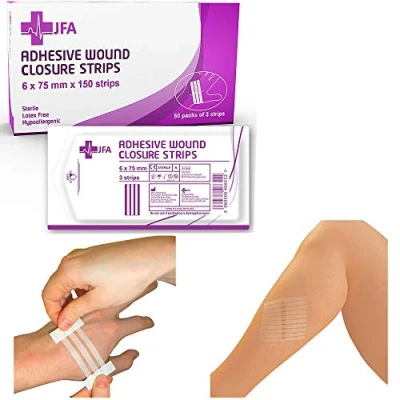 Abbildung von JFA Medical 150er Set Wundnahtstreifen Strips / Klammerpflaster Nahtmaterial Wundverschluss Streifen 6 x 75 mm