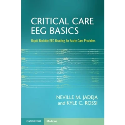 Abbildung von Critical Care EEG Basics: Rapid Bedside Reading for Acute Providers