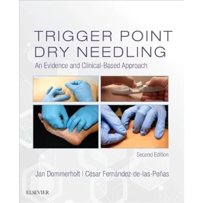 Abbildung von Trigger Point Dry Needling: An Evidence and Clinical Based Approach