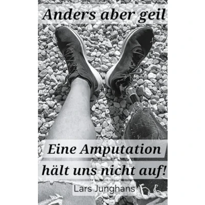 Abbildung von Anders aber geil: Eine Amputation hält uns nicht auf!