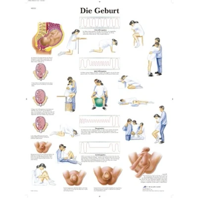 Abbildung von 3B Scientific Lehrtafel laminiert Die Geburt
