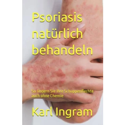 Abbildung von Psoriasis natürlich behandeln: So lindern Sie Ihre Schuppenflechte auch ohne Chemie