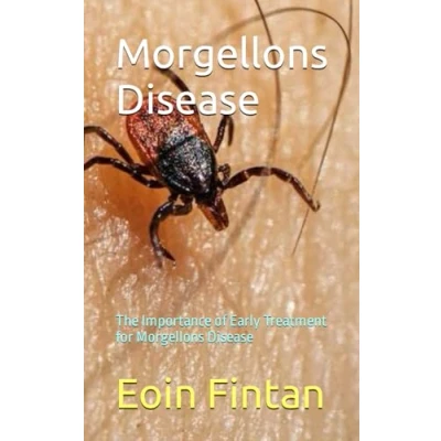 Abbildung von Morgellons Disease: The Importance of Early Treatment for Disease