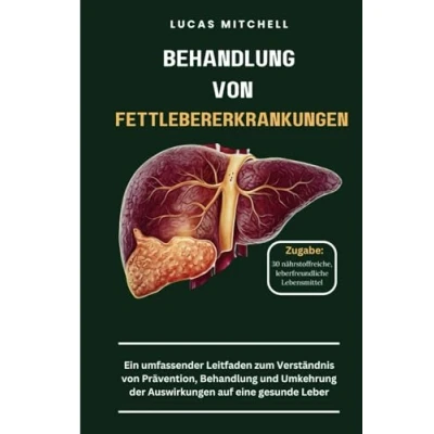 Abbildung von Behandlung von Fettlebererkrankungen: Ein umfassender Leitfaden zum Verständnis Prävention, und Umkehrung der Auswirkungen auf eine gesunde Leber