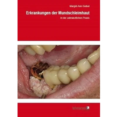 Abbildung von Erkrankungen der Mundschleimhaut: in zahnärztlichen Praxis