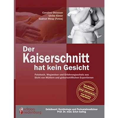 Abbildung von Der Kaiserschnitt hat kein Gesicht