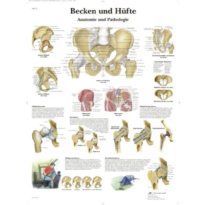 Abbildung von 3B Scientific Lehrtafel laminiert Becken und Hüfte Anatomie Pathologie