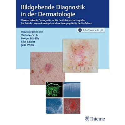 Abbildung von Bildgebende Diagnostik in der Dermatologie: Dermatoskopie, Konfokale Laserscanmikroskopie, Optische Kohärenztomografie, Sonografie