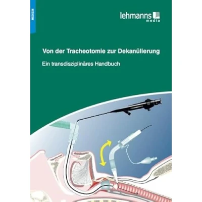 Abbildung von Von der Tracheotomie zur Dekanülierung: Ein transdisziplinäres Handbuch