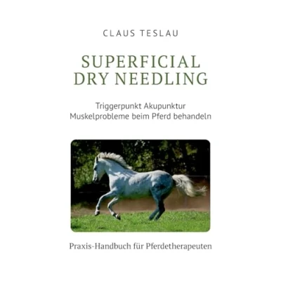 Abbildung von Superficial Dry Needling: Triggerpunkt Akupunktur und Myofasziale Tiefenmassage, Stresspunktmassage, Therapeutische Synergie