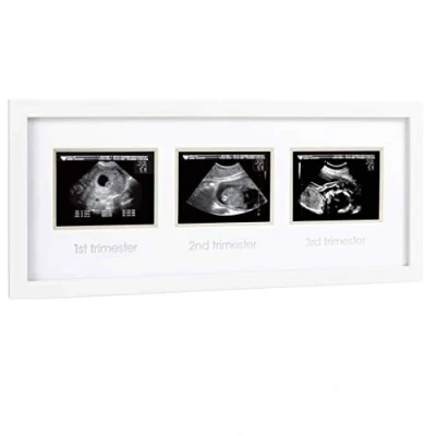 Abbildung von Pearhead Pregnancy Trimester Sonogram Frame, Ultrasound Picture Milestone Keepsake Photo Keepsake, Gender Neutral Baby Nursery Décor, 1st 2nd and 3rd Trimester, White
