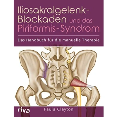 Abbildung von Iliosakralgelenk Blockaden und Das Piriformis Syndrom: Handbuch für die manuelle Therapie