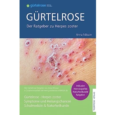 Abbildung von Gürtelrose Der große Ratgeber zu Herpes zoster: Schulmedizin + Naturheilkunde