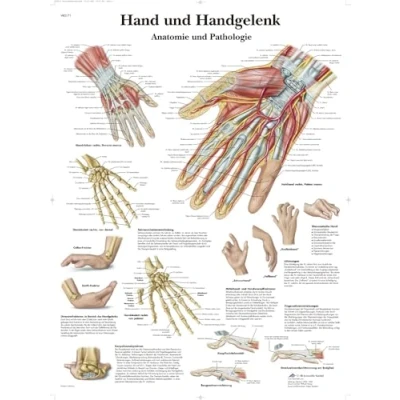 Abbildung von 3B Scientific Lehrtafel Hand und Handgelenk Anatomie Pathologie, VR0171UU