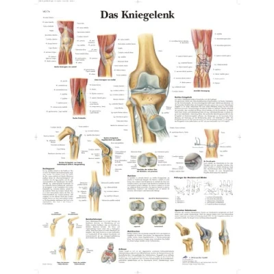 Abbildung von 3B Scientific Lehrtafel Das Kniegelenk